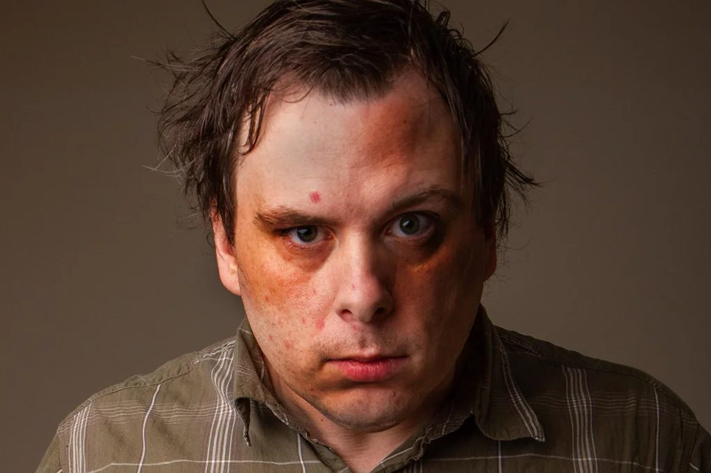 آسیب های مصرف مواد مخدر